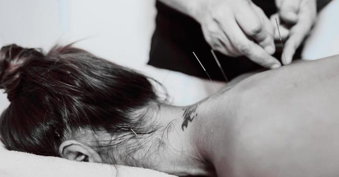 Acupuncture at (se)®: Restoring Balance
