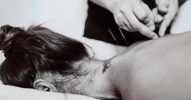 Acupuncture at (se)®: Restoring Balance image